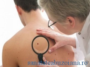 cancer de piele