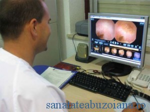 endoscopie