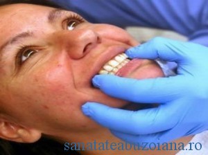 proteze dentare (1)