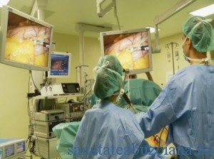 operatie laparoscopica