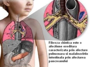 Fibroza_chistica_ro