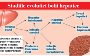 evolutia bolii hepatice