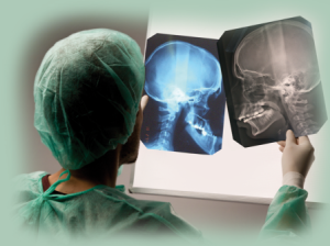 chirurgie ortognatica craniu radiografie