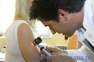 screening cancer de piele dermatoscopie