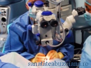 operatie-cataracta